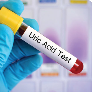 Serum Uric Acid Test in Bangla / How to calibration serum Uric Acid/ কিভাবে  serum Uric Acid করবেন ? 